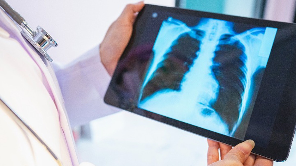 Cancer wonder drug welcomed